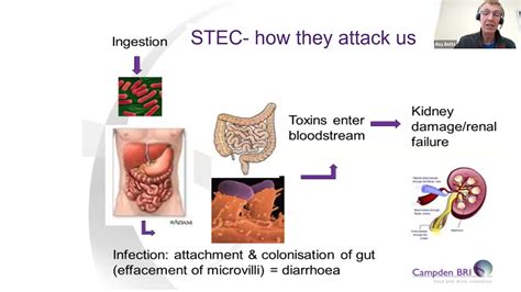 stec e coli treatment